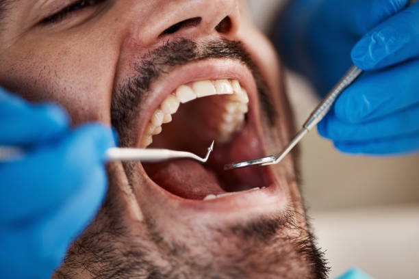 Best Broken or Chipped Tooth Repair in Pimlico, SC