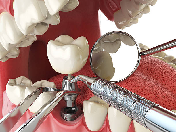 Best Emergency Cosmetic Dentistry (e.g., broken veneers) in Pimlico, SC