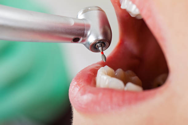 Best Dental Abscess Treatment in Pimlico, SC